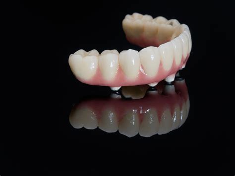 full-mouth implant in ashford